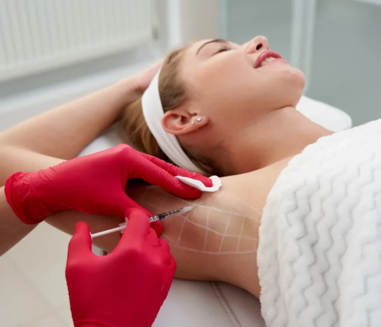 علاج زيادة التعرق بالبوتوكس